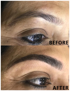 Eyes Before After