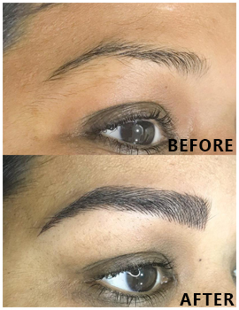Eyes Before After