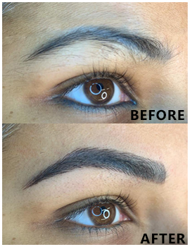 Eyes Before After