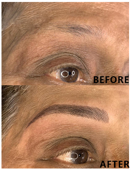 Eyes Before After