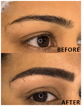 Eyes Before After
