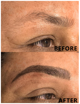 Eyes Before After