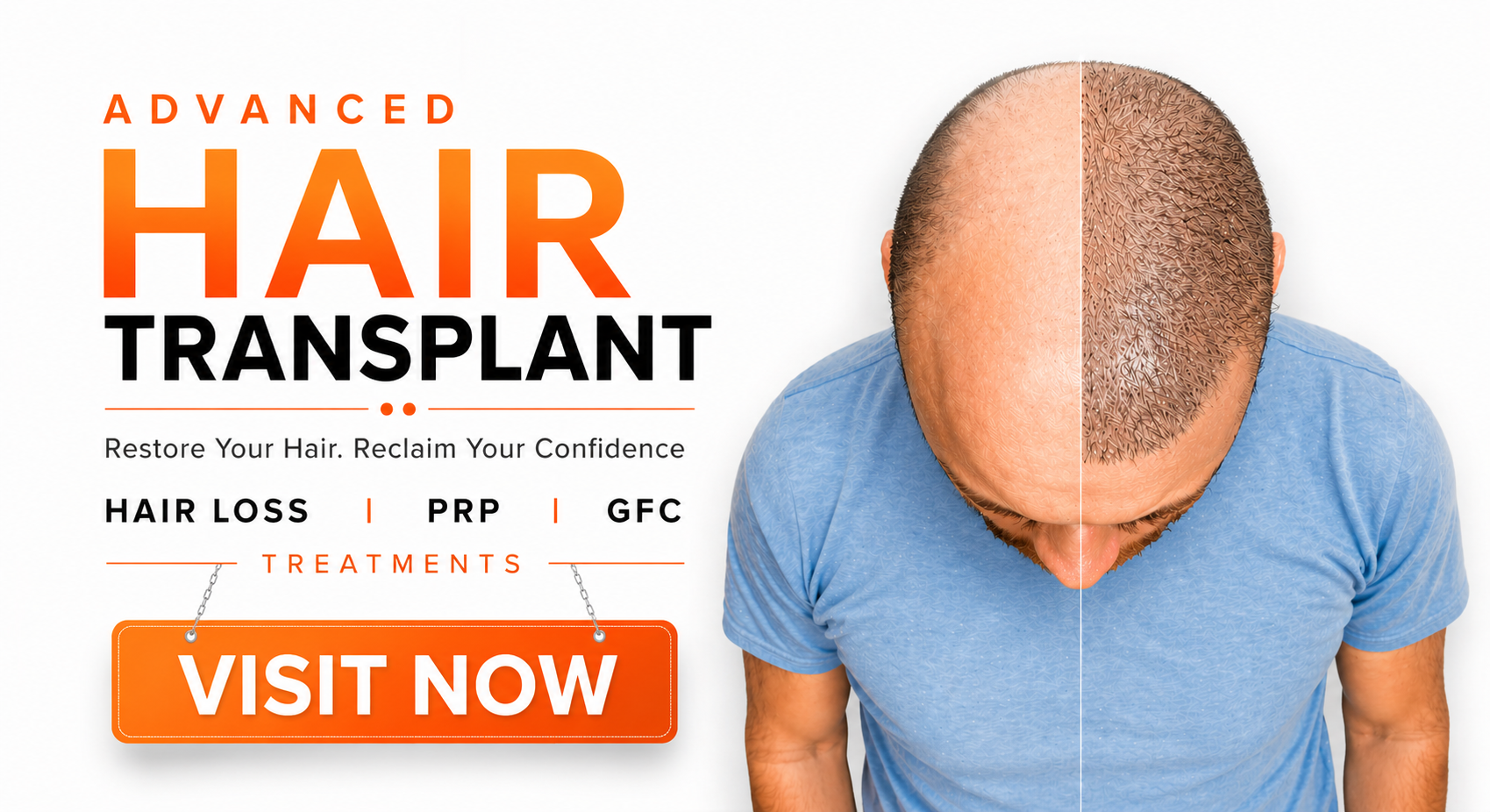 hair transplant banner