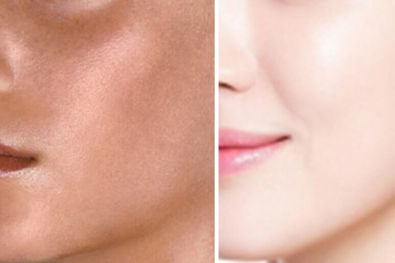 Skin Whitening