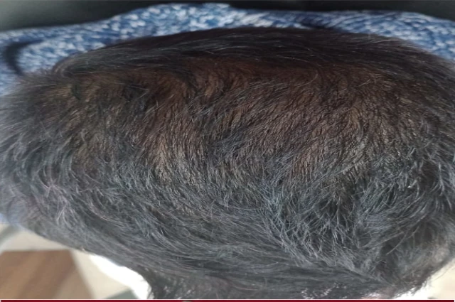 hair treatment after image