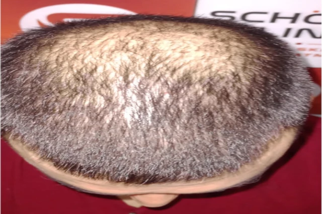 hair treatment before image