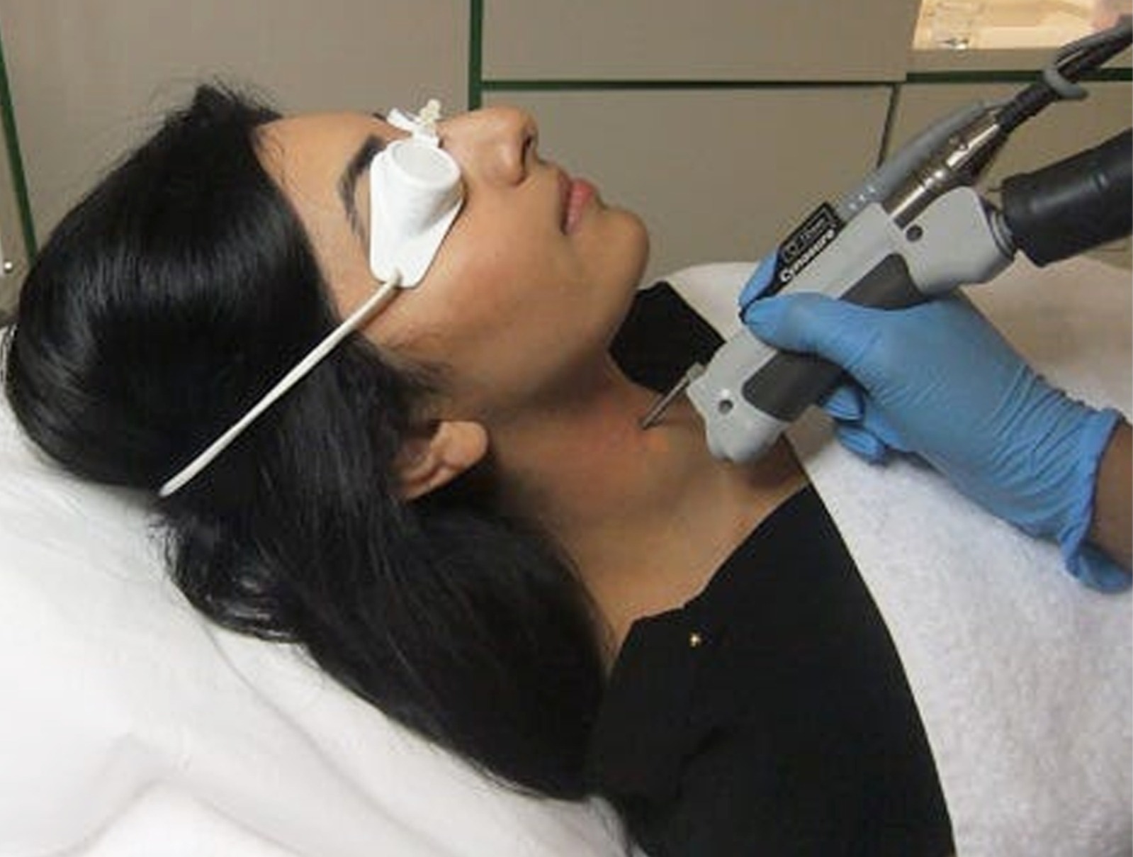 image of laser treatment